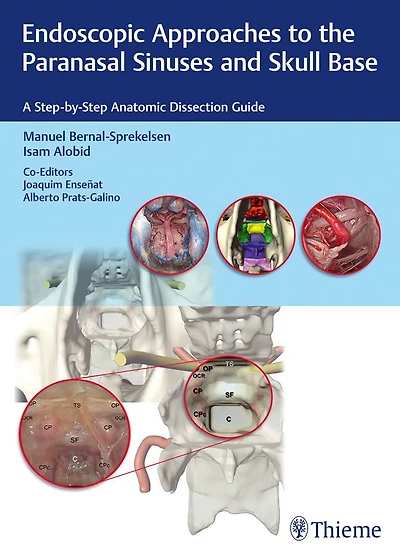 Endoscopic Approaches to the Paranasal Sinuses and Skull Base: A Step-by-Step Anatomic Dissection Guide