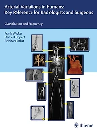 Arterial Variations in Humans: Key Reference for Radiologists and Surgeons: Classification and Frequency