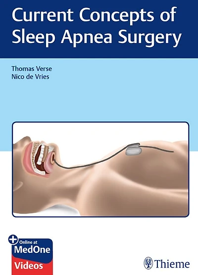 Current Concepts of Sleep Apnea Surgery