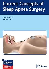 Current Concepts of Sleep Apnea Surgery