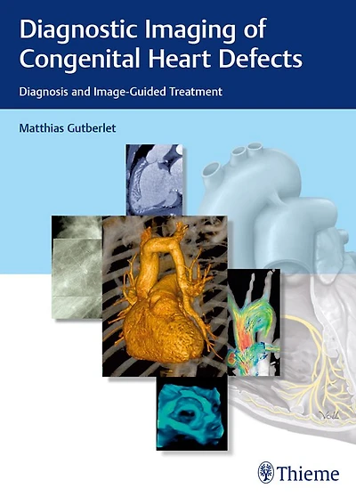 Diagnostic Imaging of Congenital Heart Defects: Diagnosis and Image-Guided Treatment
