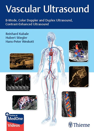 Vascular Ultrasound: B-Mode, Color Doppler and Duplex Ultrasound, Contrast-Enhanced Ultrasound