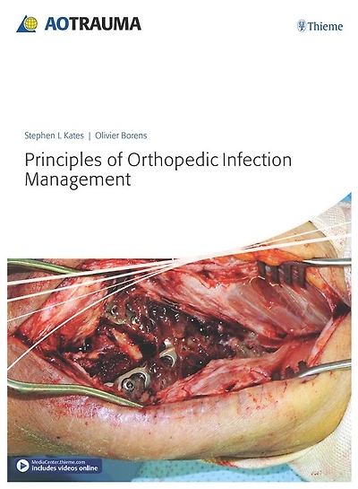 Principles of Orthopedic Infection Management