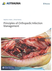 Principles of Orthopedic Infection Management