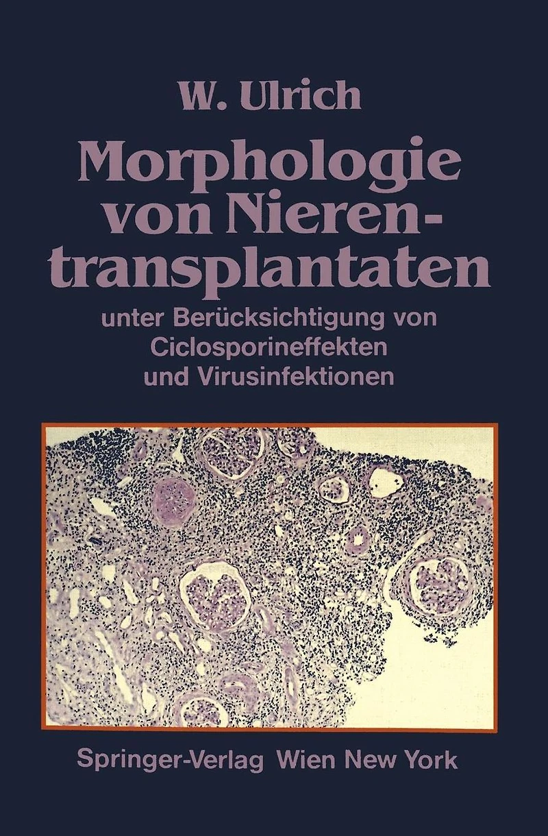 Morphologie von Nierentransplantaten: unter Ber�cksichtigung von Ciclosporineffekten und Virusinfektionen