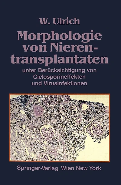 Morphologie von Nierentransplantaten: unter Berï¿½cksichtigung von Ciclosporineffekten und Virusinfektionen