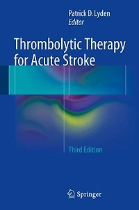 Thrombolytic Therapy for Acute Stroke