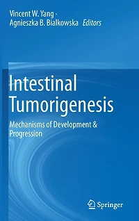 Intestinal Tumorigenesis: Mechanisms of Development & Progression
