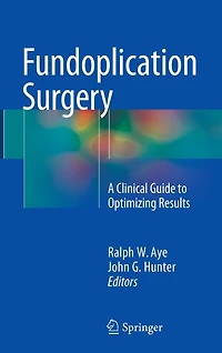 Fundoplication Surgery: A Clinical Guide to Optimizing Results