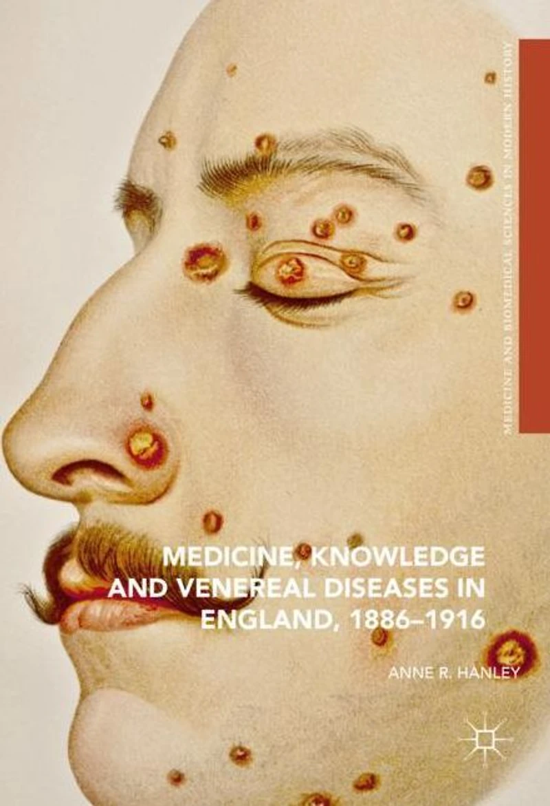 Medicine, Knowledge and Venereal Diseases England, 1886-1916