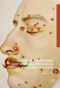 Medicine, Knowledge and Venereal Diseases England, 1886-1916