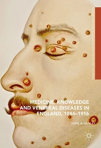 Medicine, Knowledge and Venereal Diseases England, 1886-1916