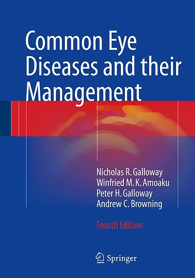 Common Eye Diseases and their Management