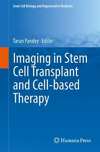 Imaging Stem Cell Transplant and Cell-based Therapy