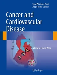 Cancer and Cardiovascular Disease: A Concise Clinical Atlas