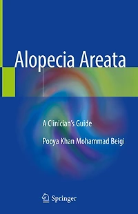 Alopecia Areata: A Clinician's Guide