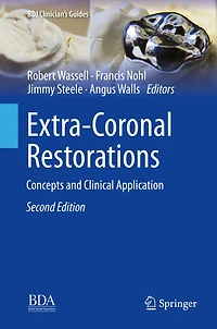 Extra-Coronal Restorations: Concepts and Clinical Application