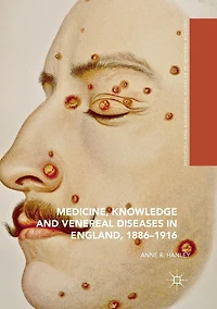Medicine, Knowledge and Venereal Diseases England, 1886-1916