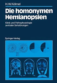 Die homonymen Hemianopsien: Klinik und Pathophysiologie zentraler Sehstï¿½rungen