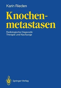 Knochenmetastasen: Radiologische Diagnostik, Therapie und Nachsorge