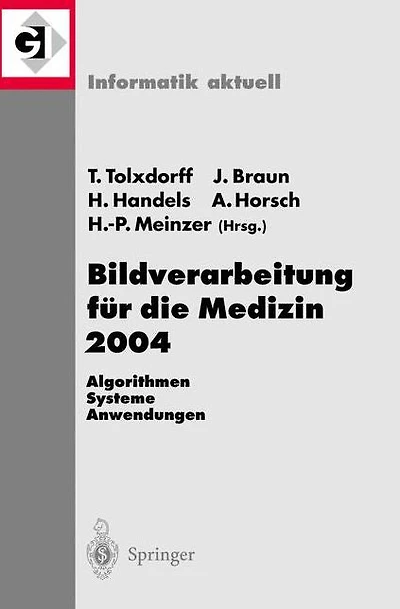 Bildverarbeitung für die Medizin 2004: Algorithmen - Systeme - Anwendungen