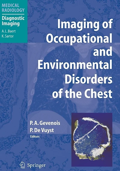 Imaging of Occupational and Environmental Disorders the Chest