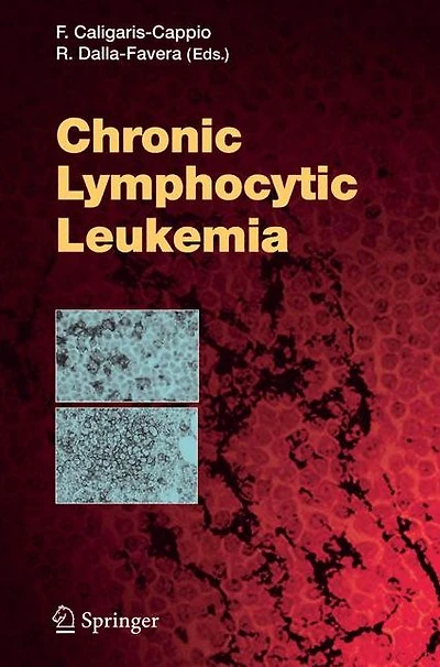 Chronic Lymphocytic Leukemia