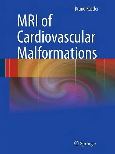 MRI of Cardiovascular Malformations
