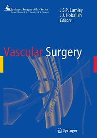 Vascular Surgery