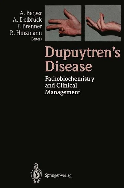 Dupuytren's Disease: Pathobiochemistry and Clinical Management