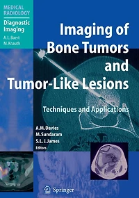 Imaging of Bone Tumors and Tumor-Like Lesions: Techniques Applications
