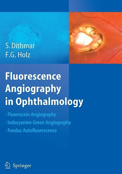 Fluorescence Angiography Ophthalmology