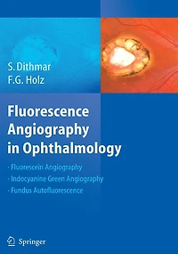 Fluorescence Angiography Ophthalmology