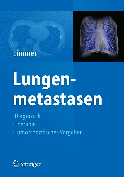 Lungenmetastasen: Diagnostik - Therapie - Tumorspezifisches Vorgehen
