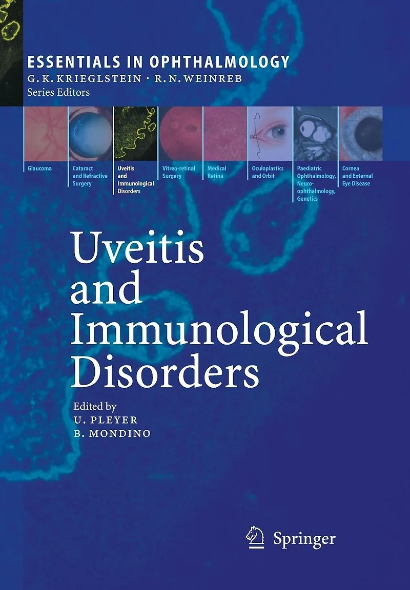 Uveitis and Immunological Disorders