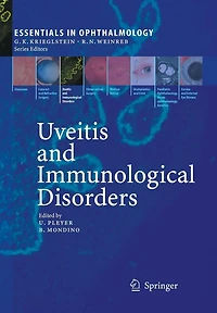 Uveitis and Immunological Disorders
