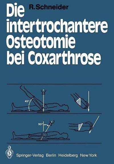 Die intertrochantere Osteotomie bei Coxarthrose