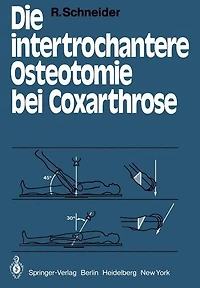 Die intertrochantere Osteotomie bei Coxarthrose