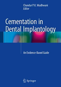 Cementation in Dental Implantology: An Evidence-Based Guide