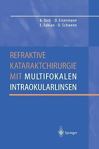 Refraktive Kataraktchirurgie mit multifokalen Intraokularlinsen