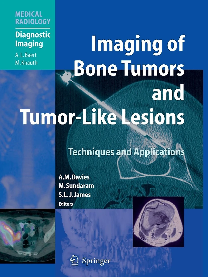 Imaging of Bone Tumors and Tumor-Like Lesions: Techniques Applications