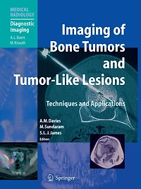Imaging of Bone Tumors and Tumor-Like Lesions: Techniques Applications