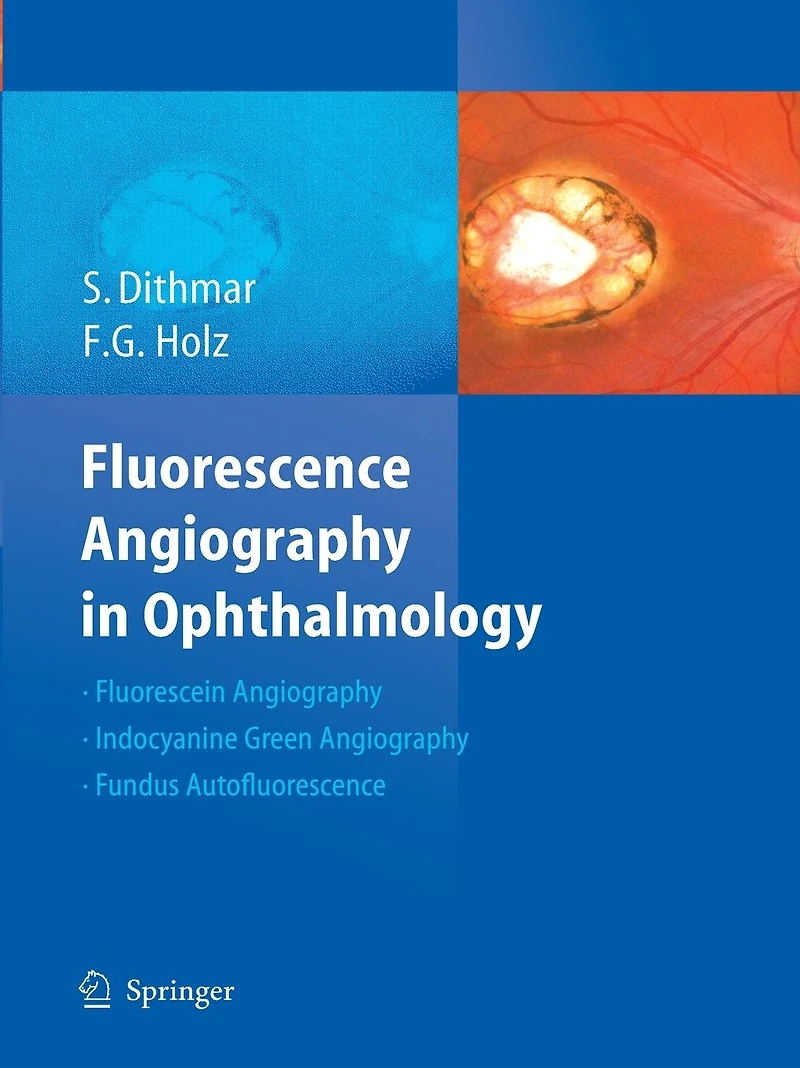 Fluorescence Angiography Ophthalmology