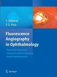 Fluorescence Angiography Ophthalmology