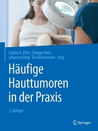 Hï¿½ufige Hauttumoren in der Praxis