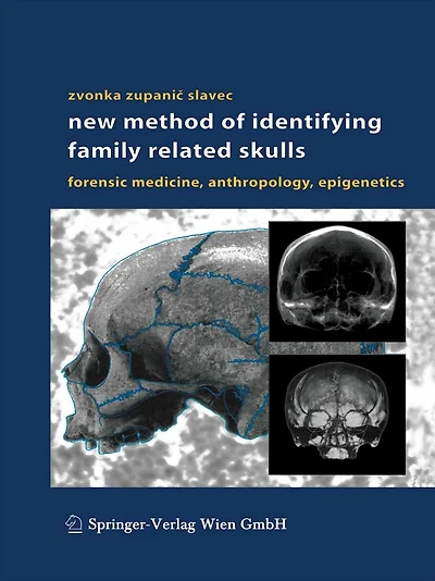 New Method of Identifying Family Related Skulls: Forensic Medicine, Anthropology, Epigenetics