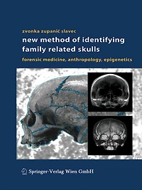 New Method of Identifying Family Related Skulls: Forensic Medicine, Anthropology, Epigenetics