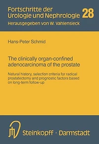 The clinically organ-confined adenocarcinoma of the prostate: Natural history, selection criteria for radical prostatectomy and prognostic factors based on long-term follow-up