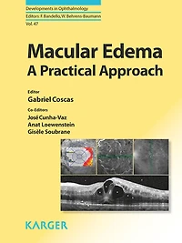 Macular Edema: A Practical Approach.