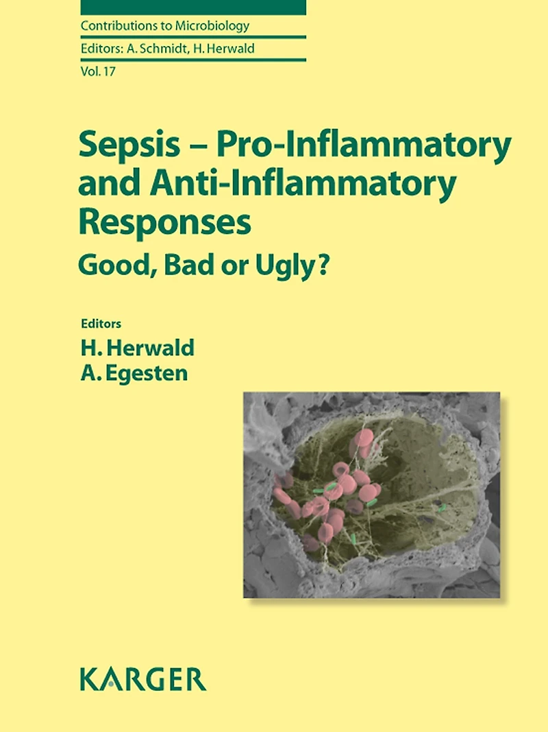 Sepsis - Pro-Inflammatory and Anti-Inflammatory Responses: Good, Bad or Ugly?.